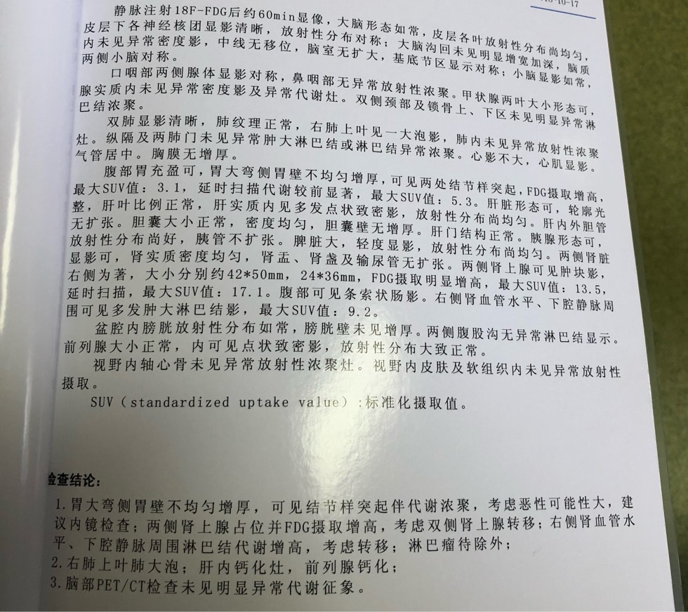 175529ozfwnfif8jin8o55.jpg