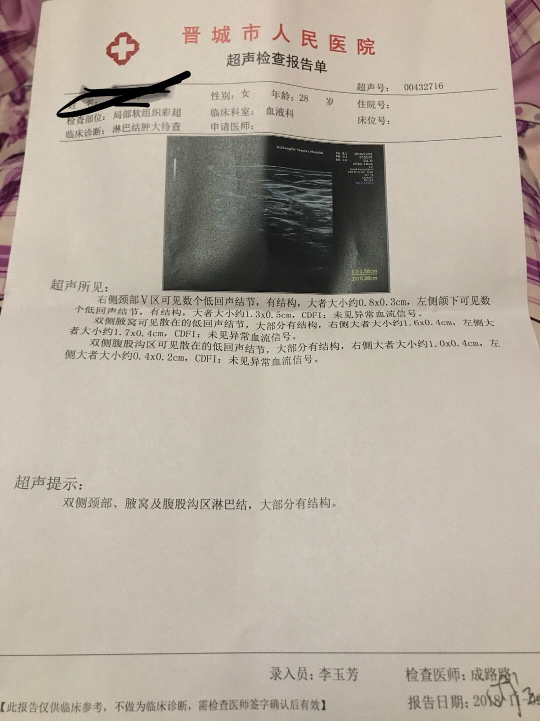 180956dr4hc455dvsnrehj.jpeg