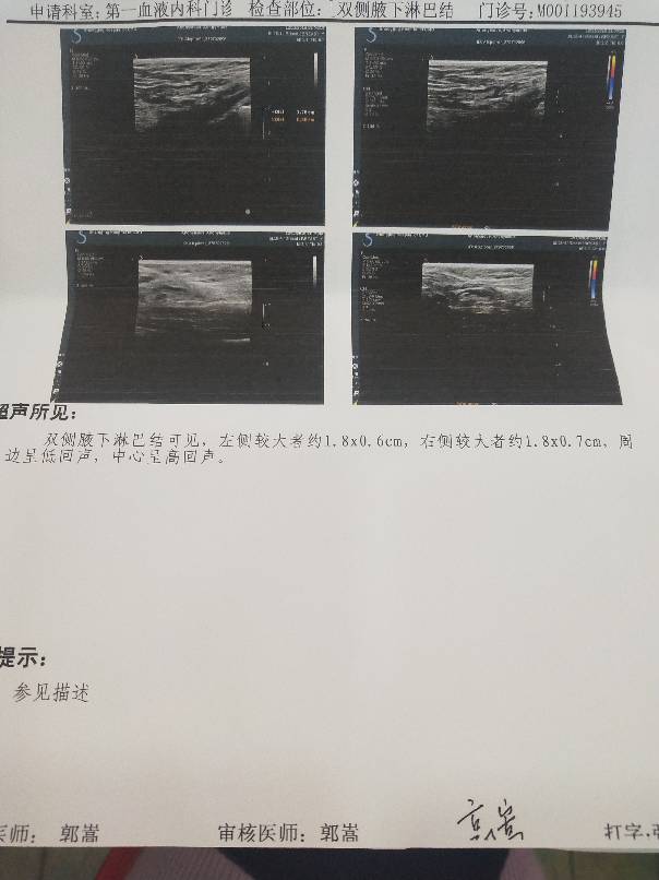 121901tc4xpgi4qi2a8e6g.jpg