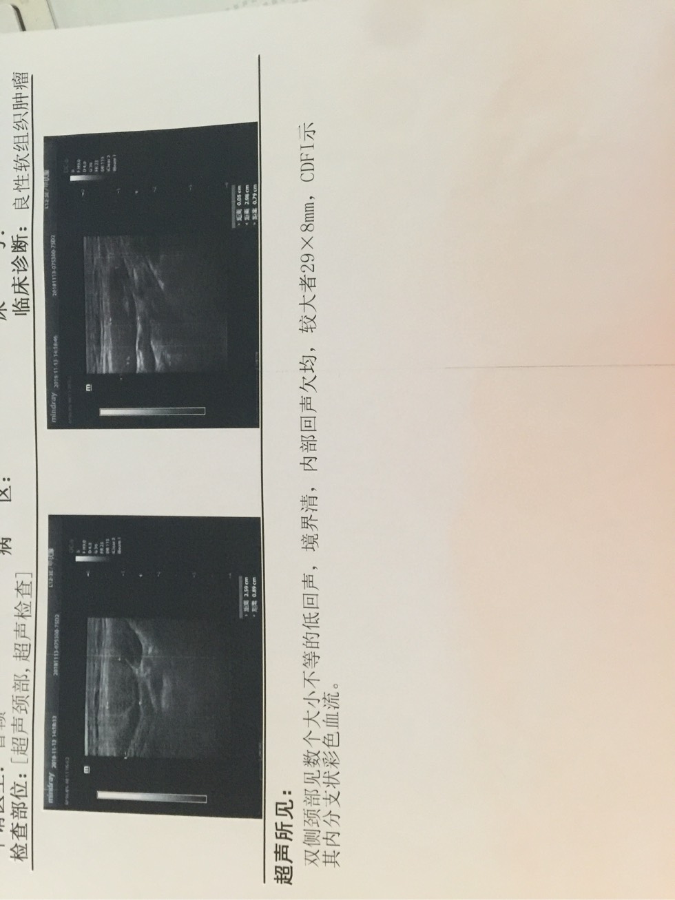 171510x35u5s838q83gp3k.jpg