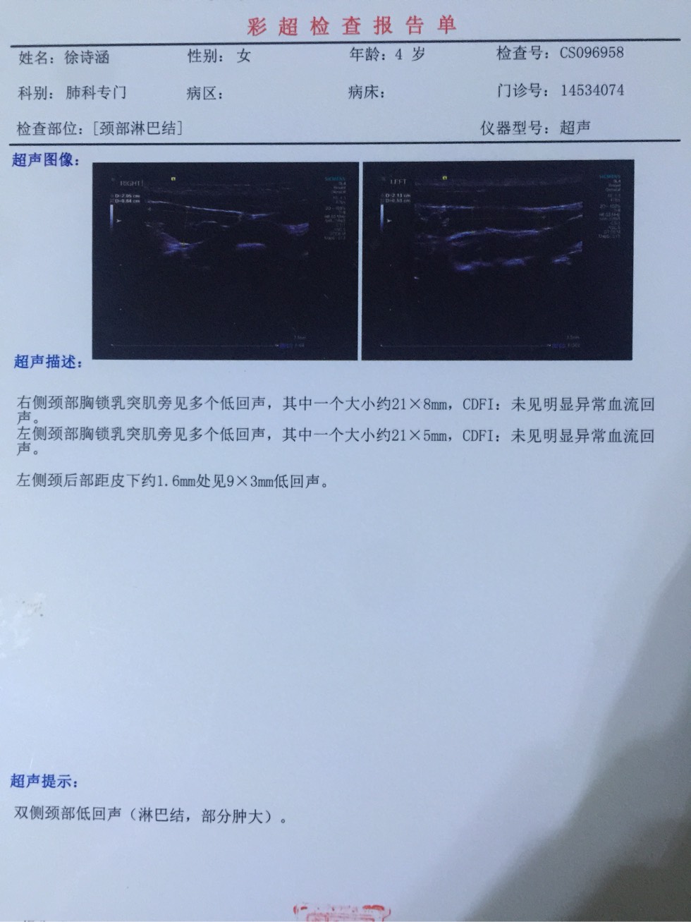 094422mdcv7q1cpv1dd2pu.jpg