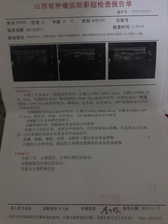 085456r3t511ztm7v7tsmp.jpeg