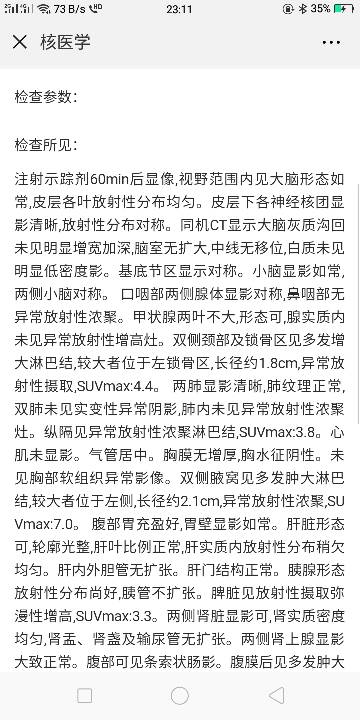 171357e3hjuhhow3juukju.png