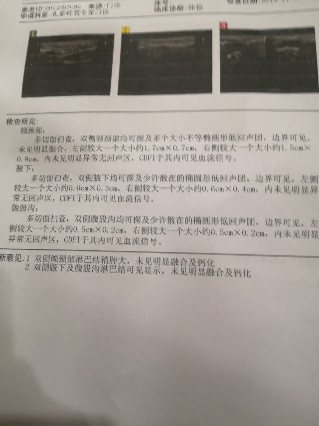 111715dn1qqiinmk2roynf.jpg