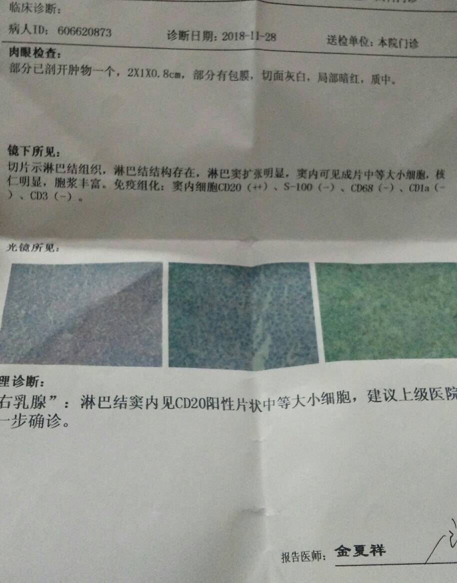131835r3737se7bkb5574e.jpg