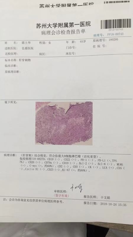肝部穿刺病理