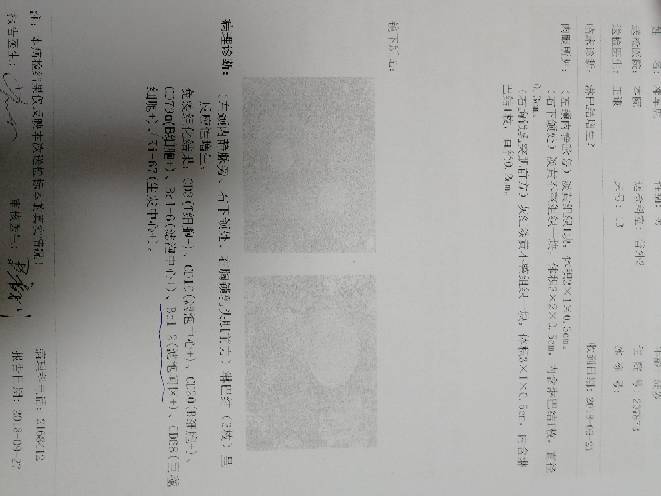 084622e504t6fbz6doc6ml.jpg