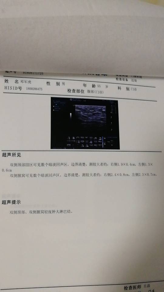 084624vbgb06hqaqoq6hga.jpg