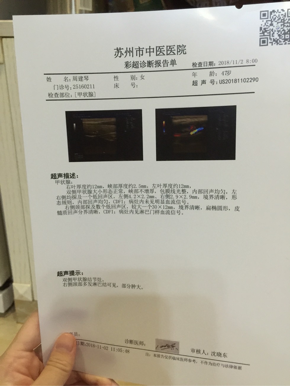 152619qy6tj6ef481liyis.jpg