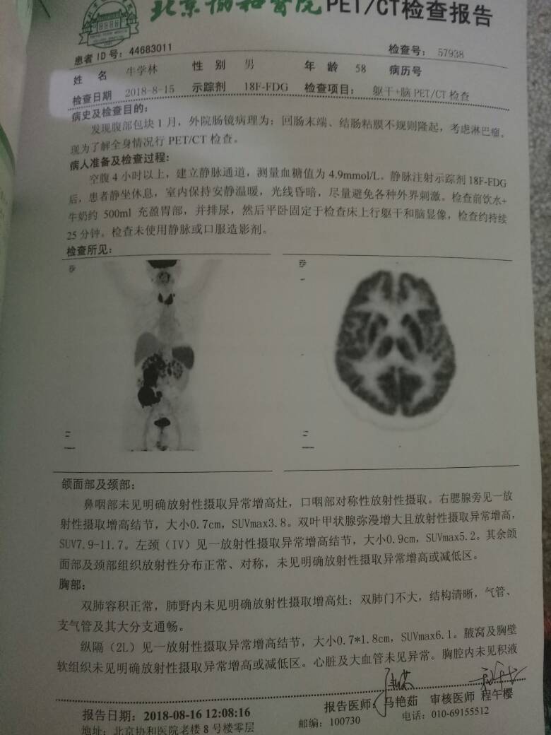 104541oikk001iv2qz96xm.jpg