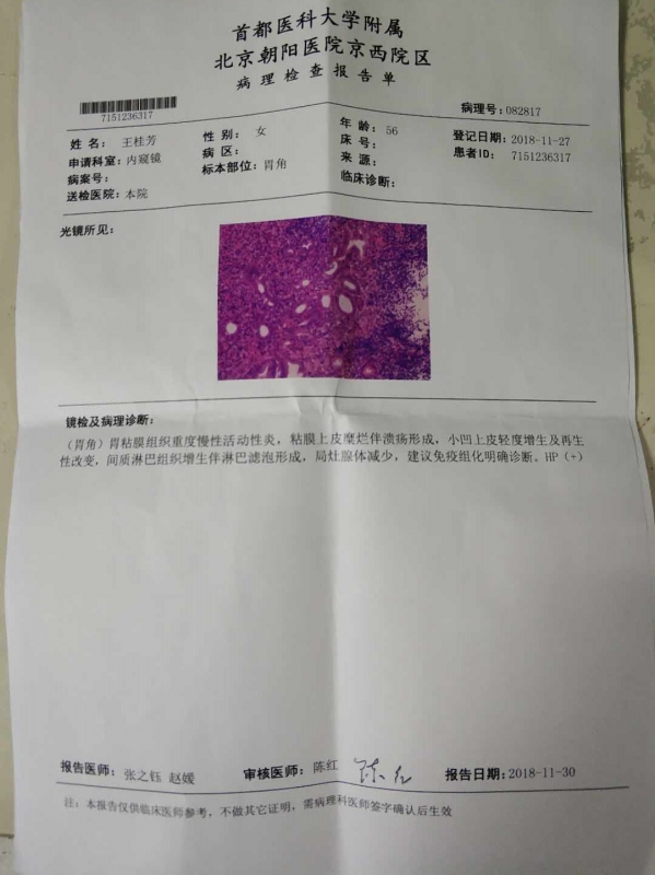 2、病理结果
