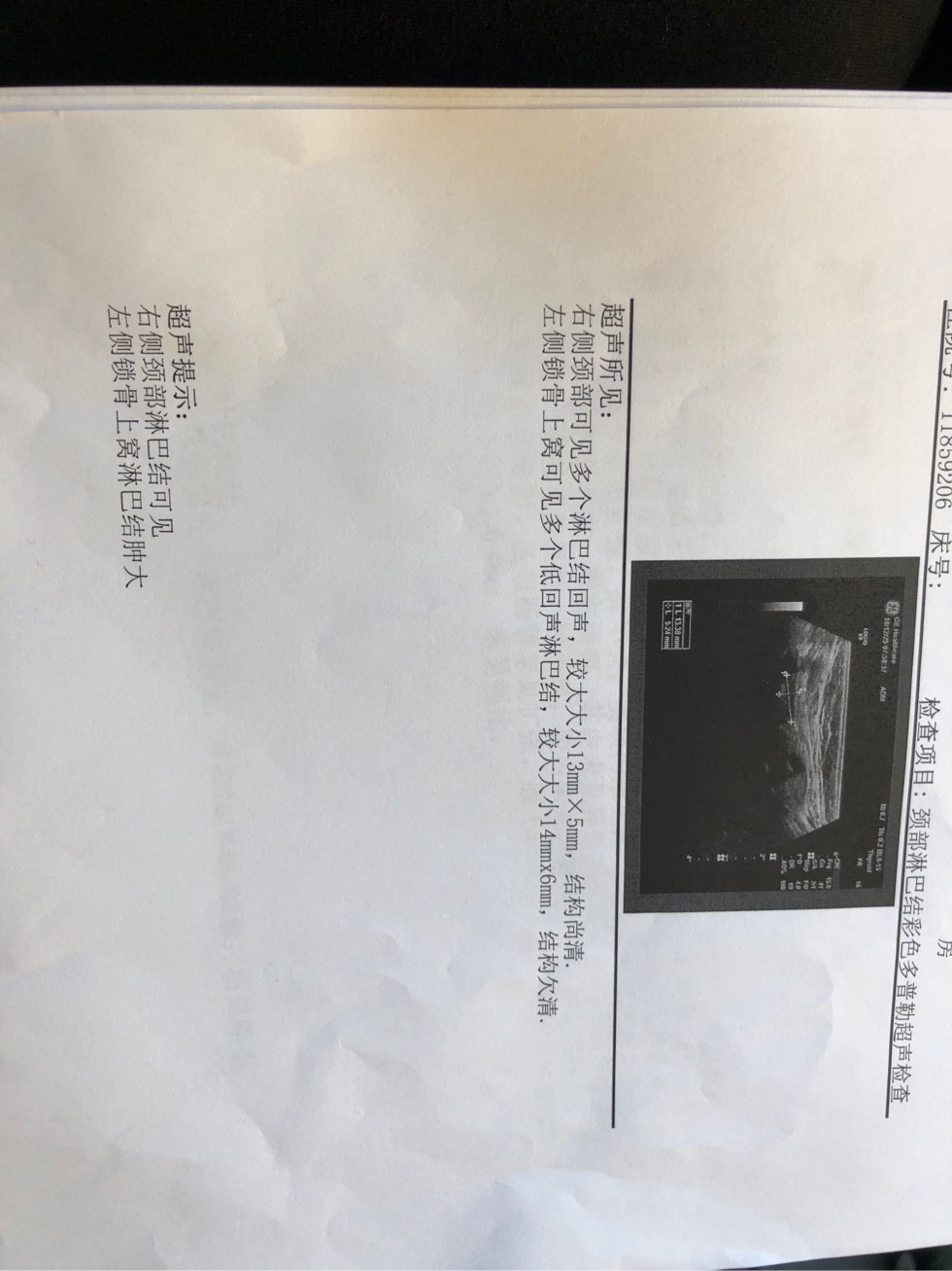 124346r60yk0963n340wks.jpg