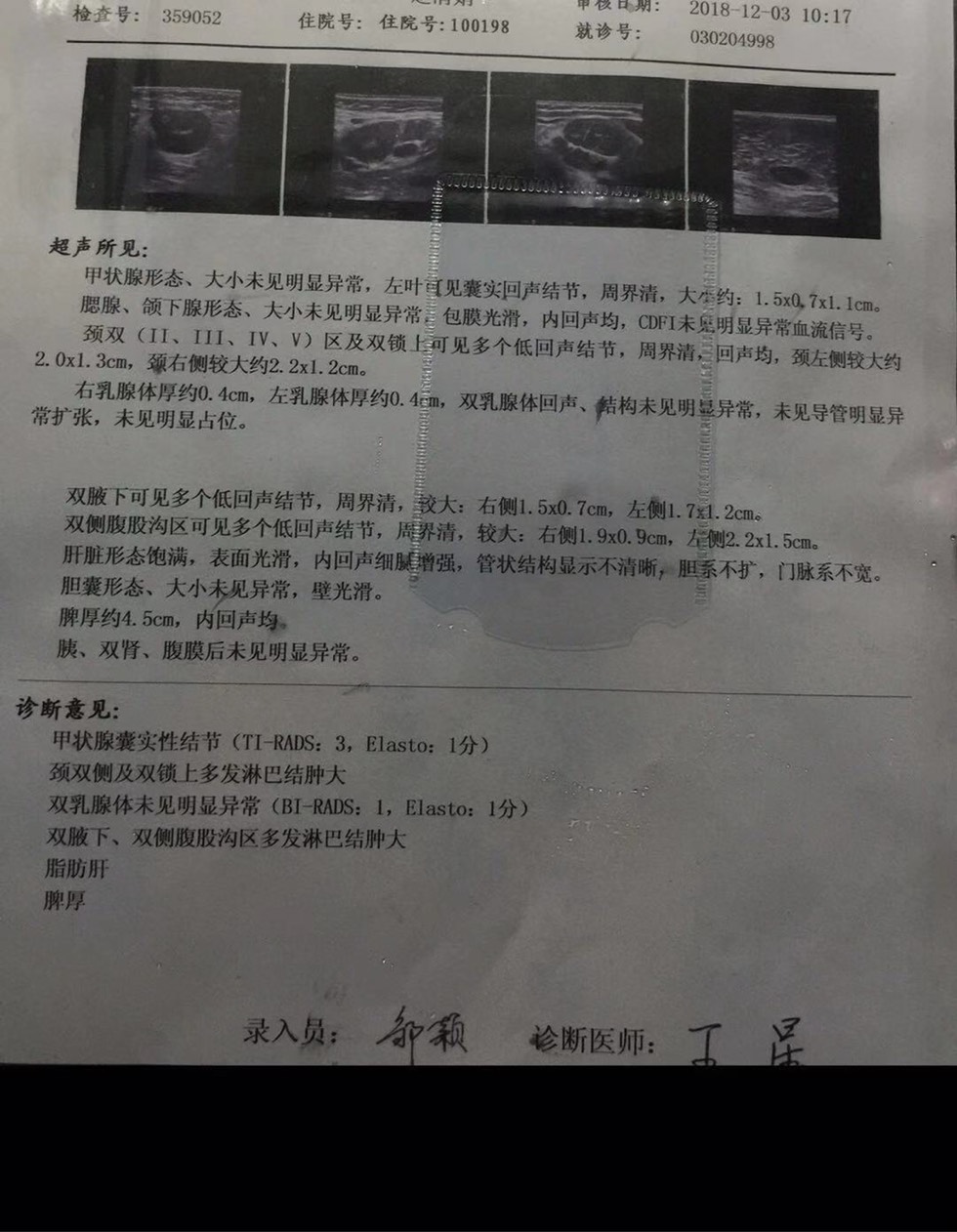 140509nb00xskbzsbkakkt.jpg