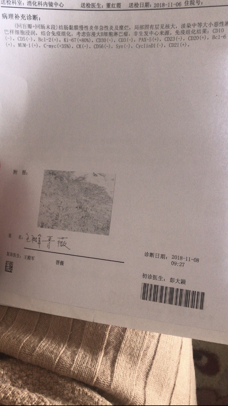 171017zc1xxx0p5ixxlzms.jpg