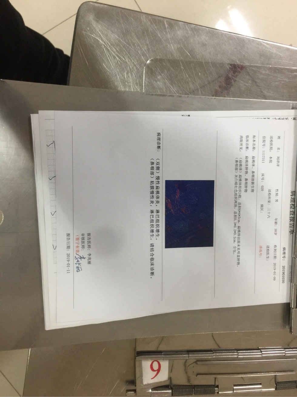 170935zcqc3yc8hhc6y3ff.jpg