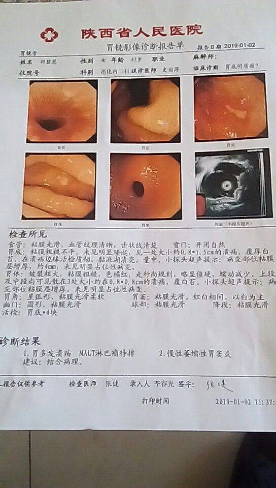 231740tfbxopnxn9ln1tte.jpg