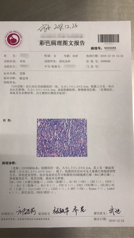 术后肠息肉手术病理报告