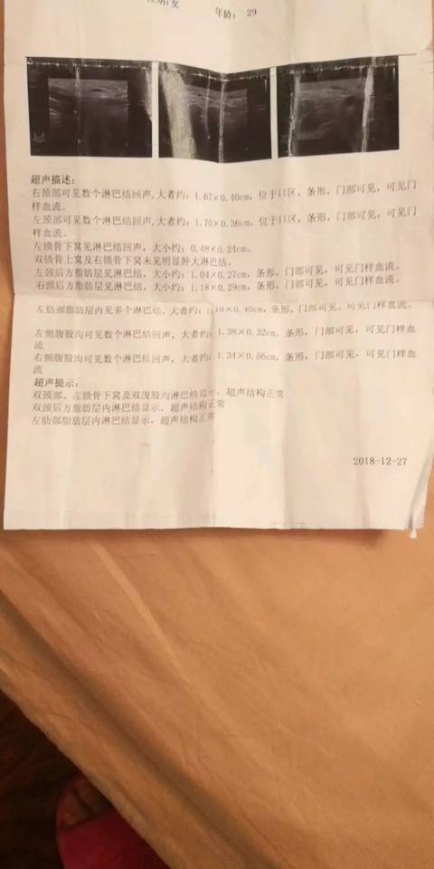 200547zjm1i3ihi1b11a2b.jpg