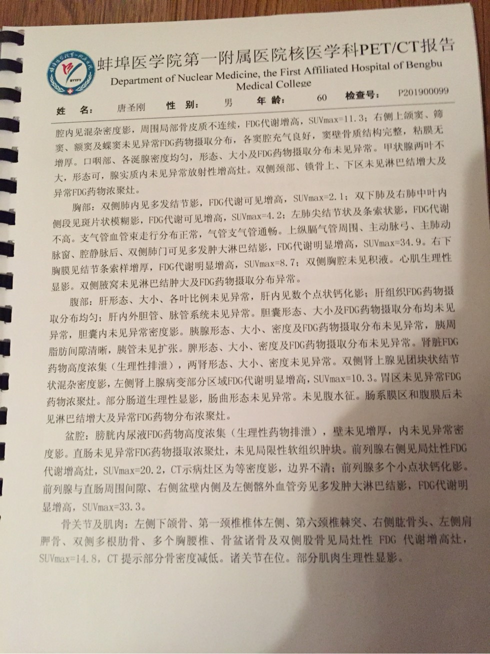 035725osshbhzhmfefbne8.jpg