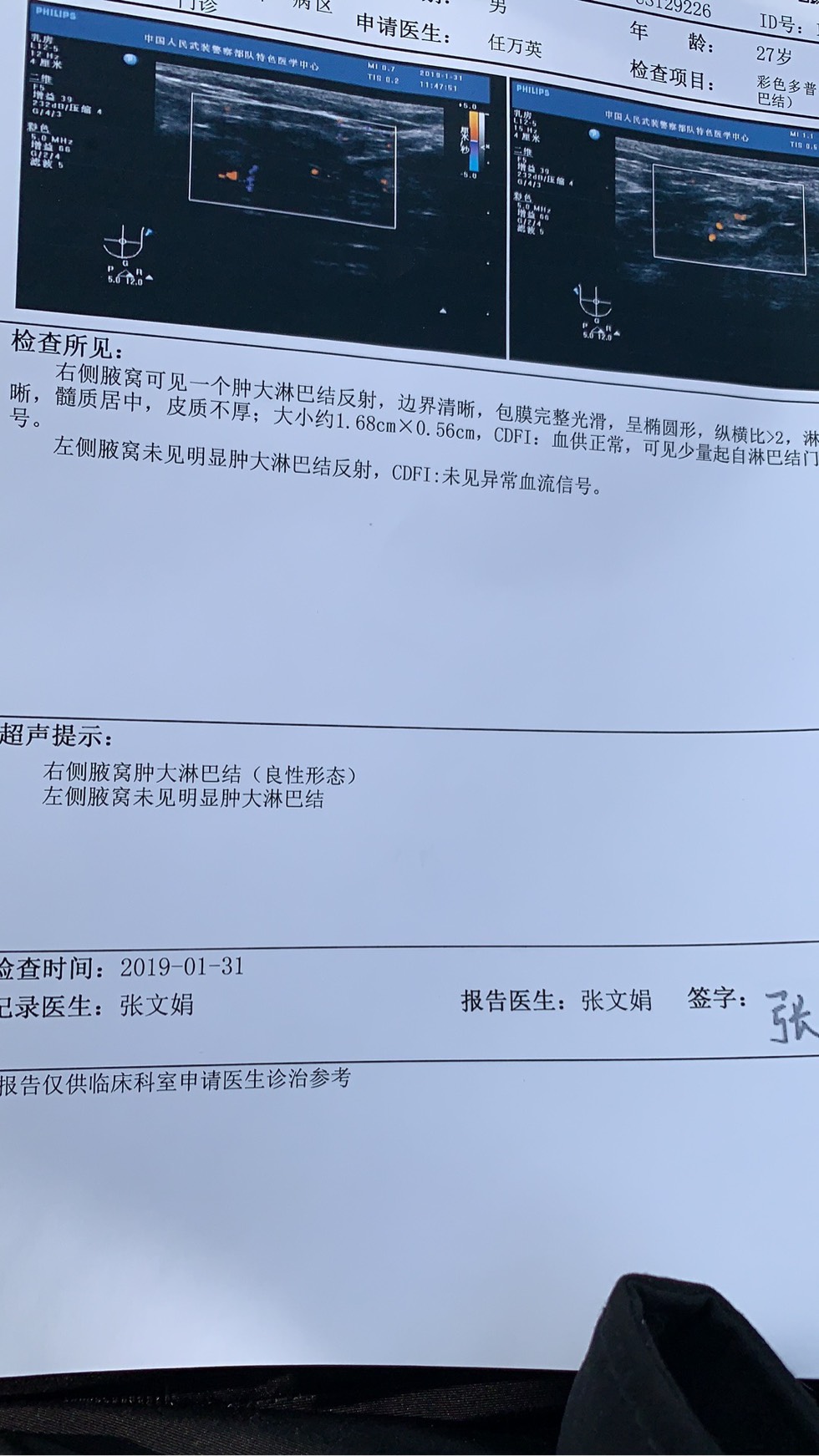 003826n7ztq6jnat9a7ct3.jpg