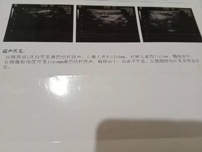 141412lk3gkenf2ya3fue3.jpg