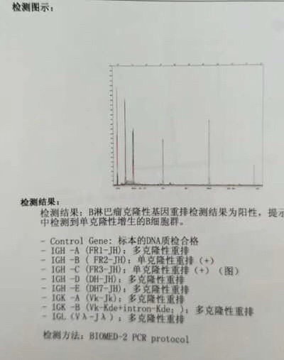 171210cf5mq6rt9baeft93.jpg