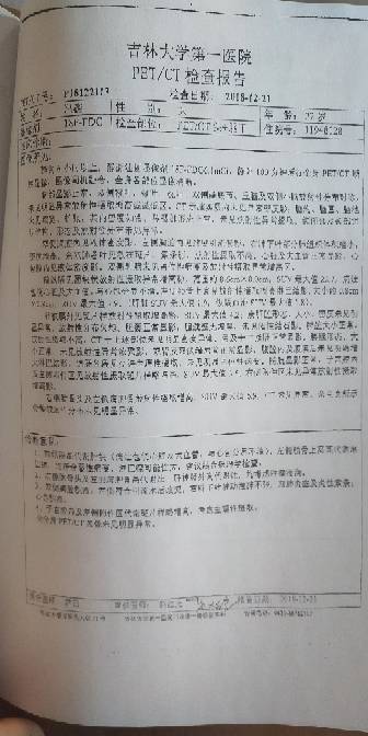 123908l5cdm33zg0durhu0.jpg