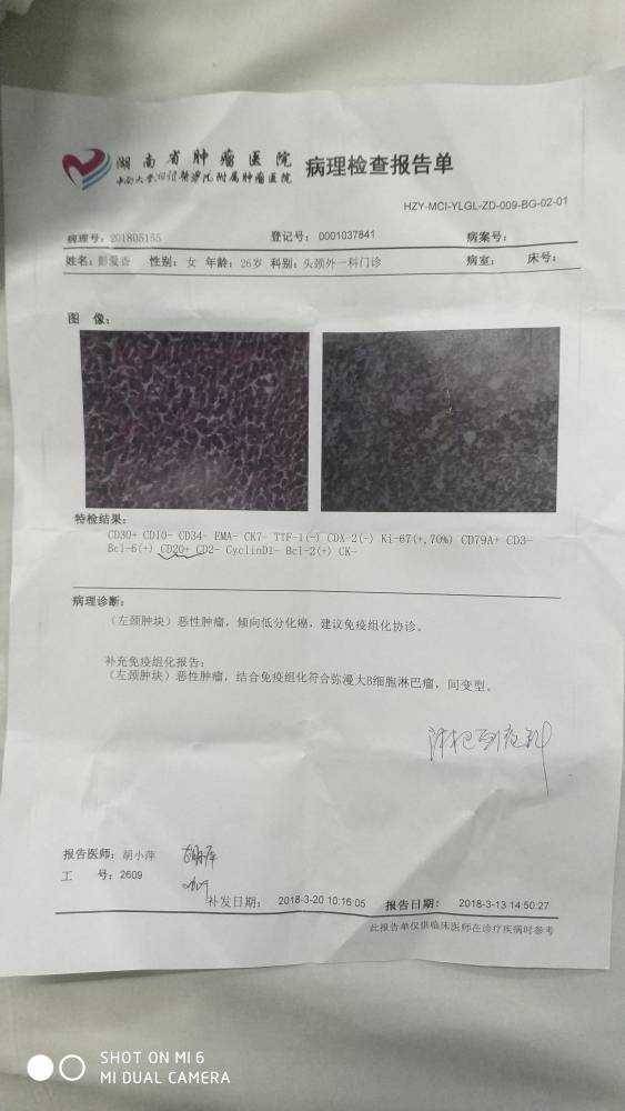 214556h9scc9ccgnzn33bc.jpg