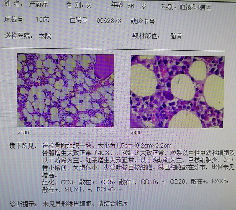 骨髓组化报告