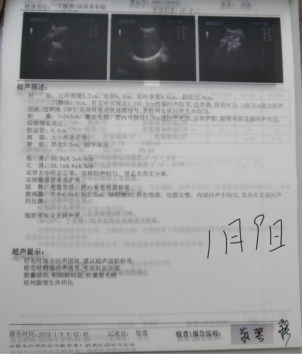 142032b25qhqtt3tutu2ip.jpg