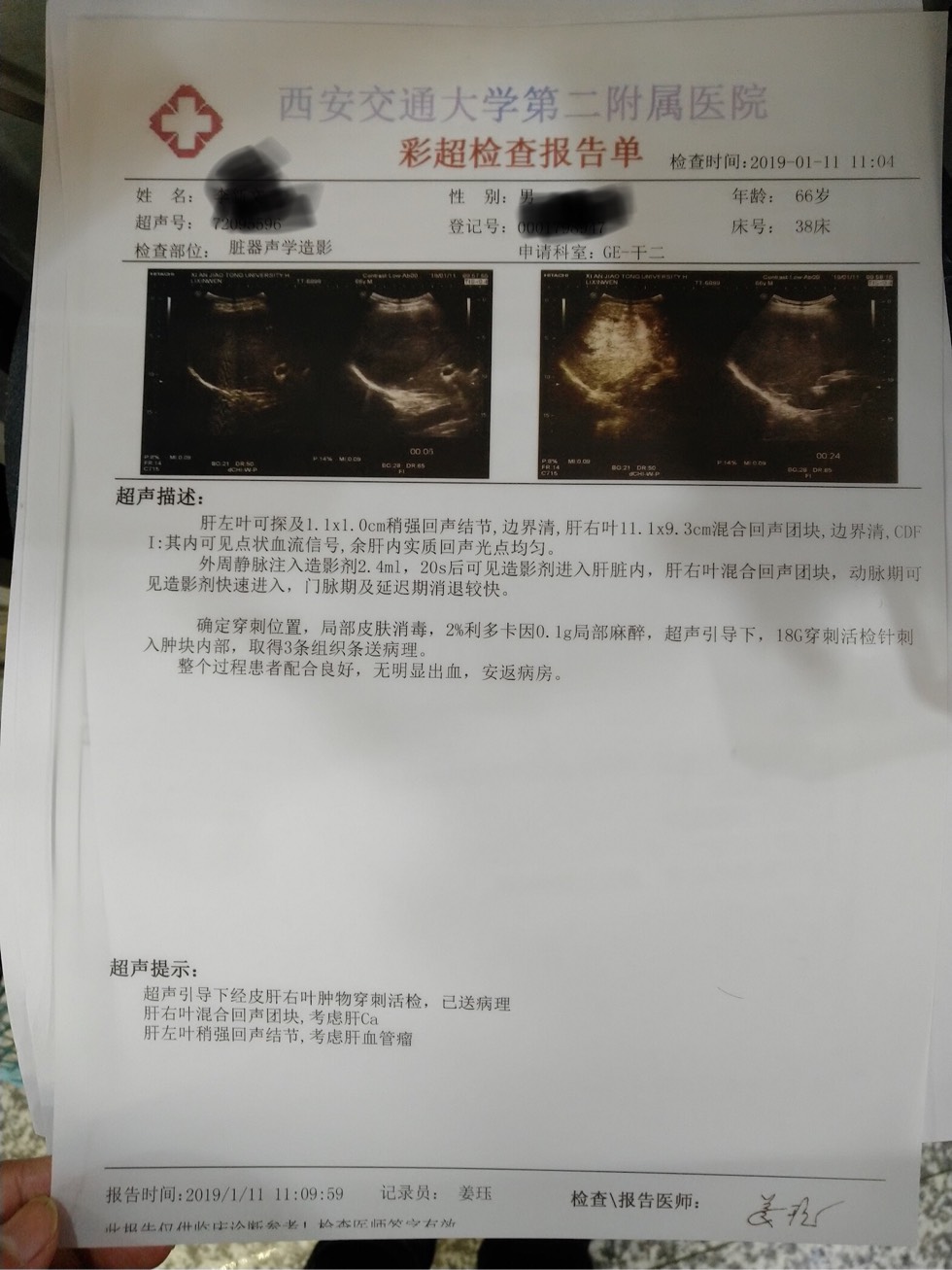 142035ewzz5i7zyyjj7dzm.jpg