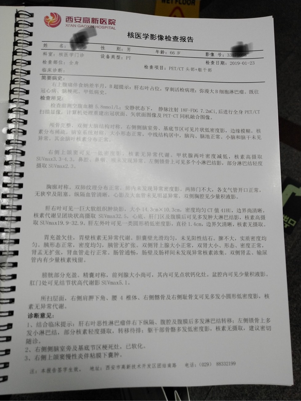 142037nmjeu4jjhc5oog5j.jpg