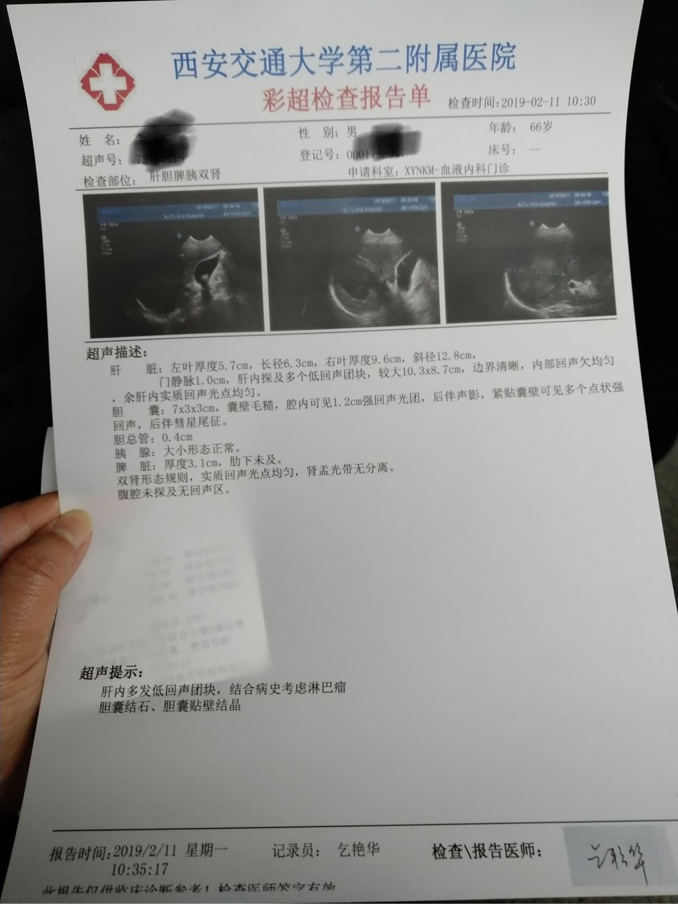 142039pryeeq4ix46jv3vn.jpg