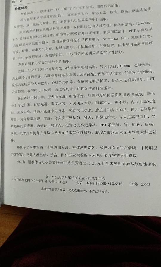 194404qyjw8u8a1zyymx3e.jpg