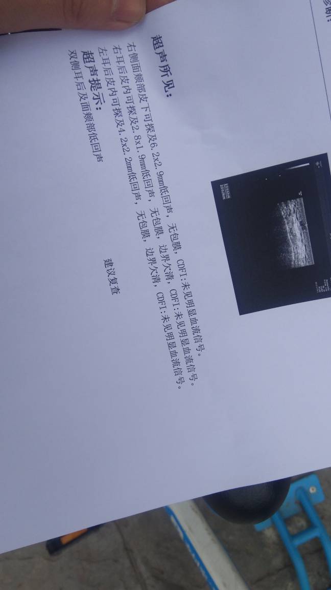 203056nzynnc1r70ym5qnb.jpg