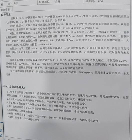 152609u9a49ea8vku04ckf.jpg