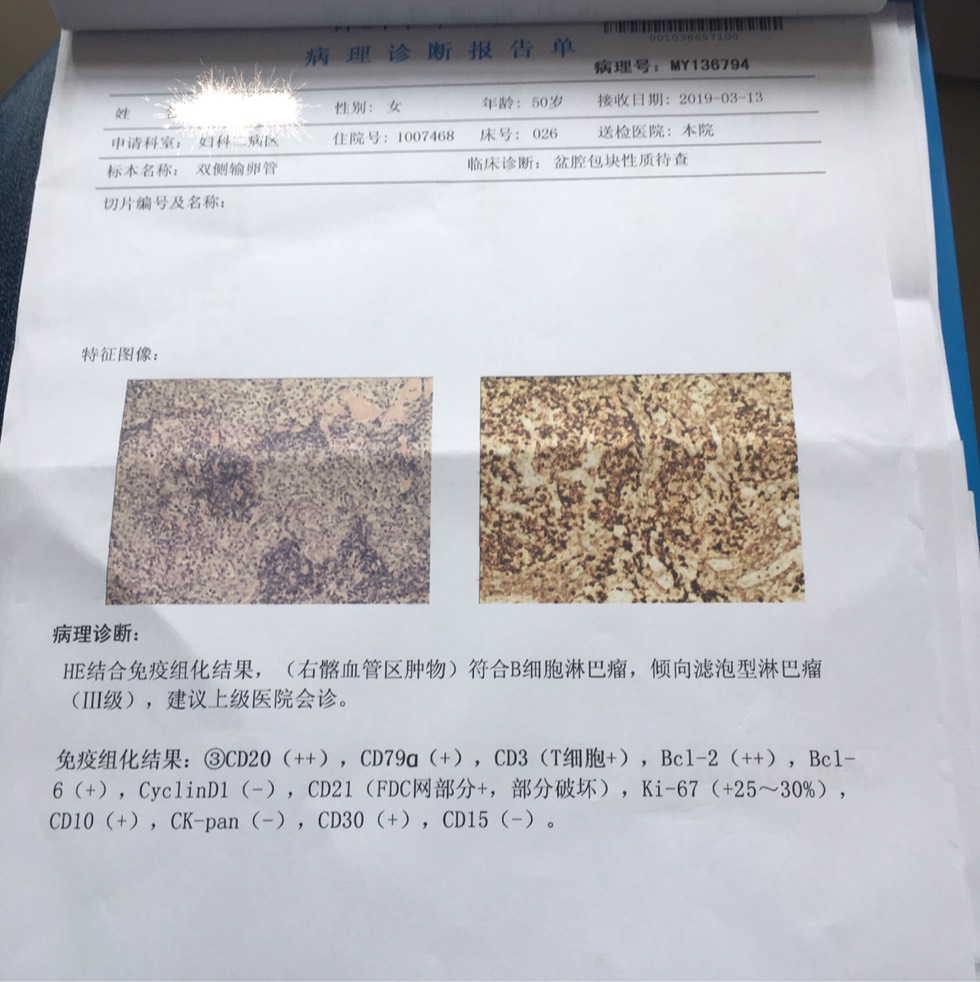 102028i6dcqfcunndhiiqd.jpg