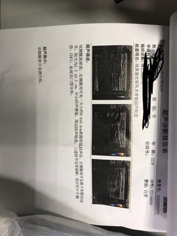 145135x4bifmqq4ft2qmmi.jpg