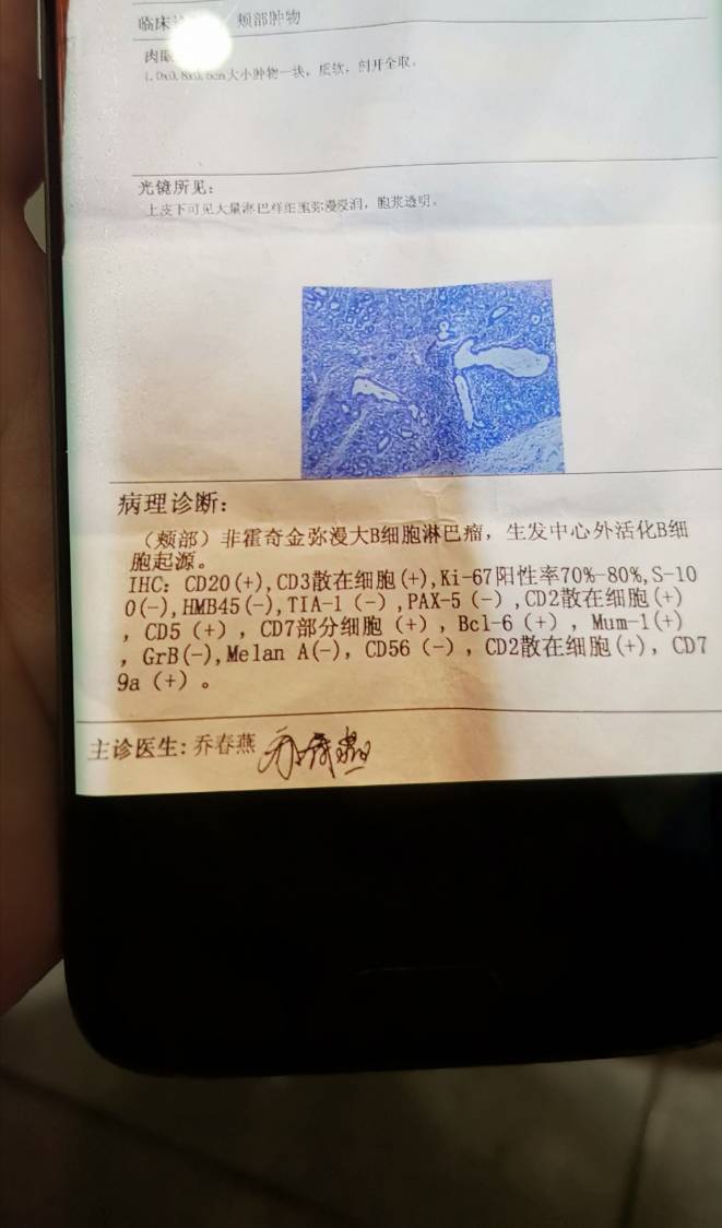 160303yoj30g8000zydehz.jpg