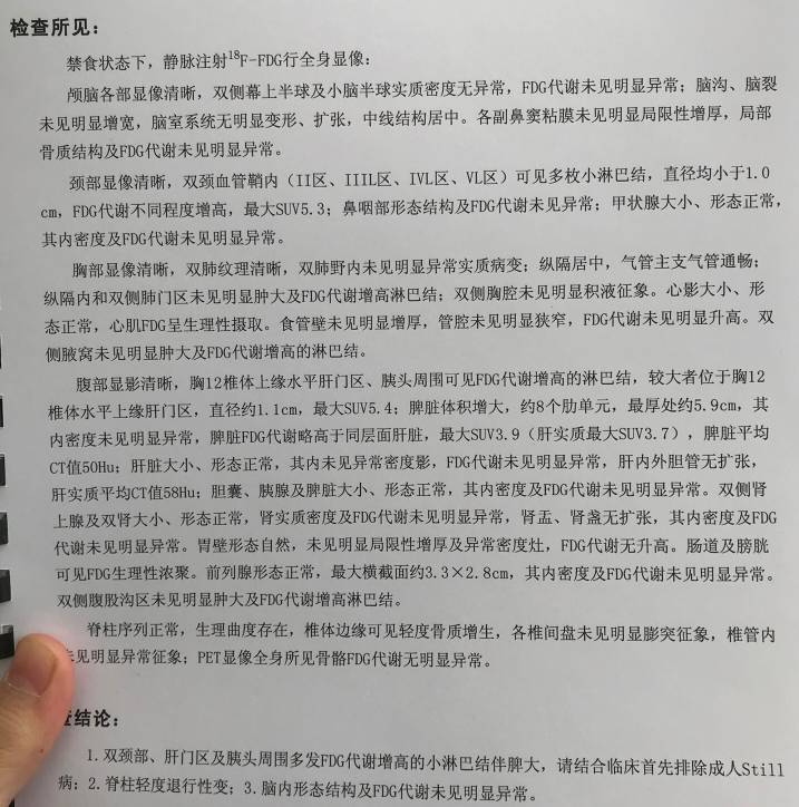 121204ka11o0azejc433ew.jpg