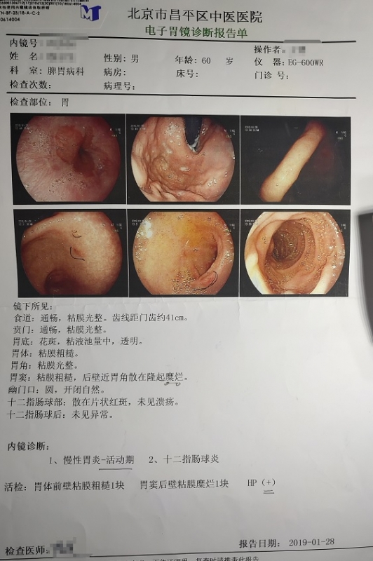 胃镜报告