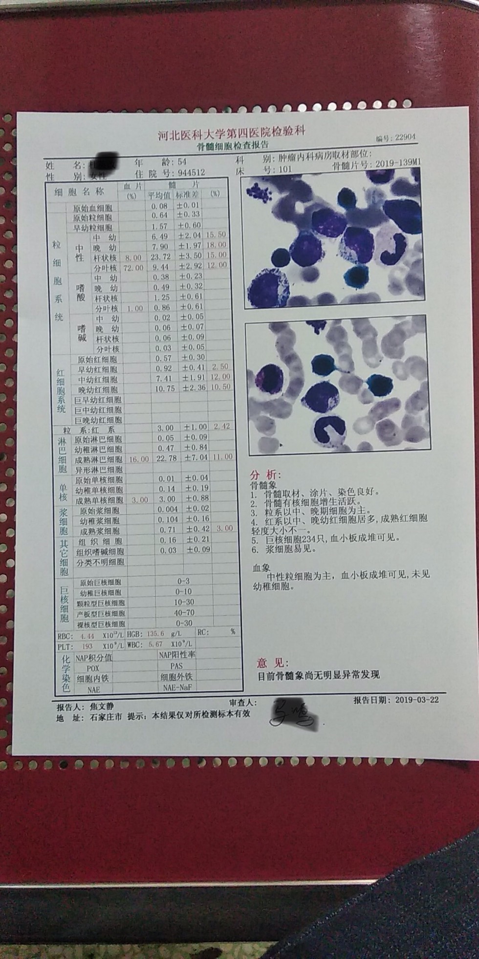 004546whcbwpa2ahy4iwcb.jpg