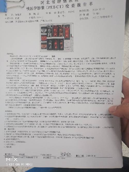 181550xyeodnox8ufu8v1z.jpg