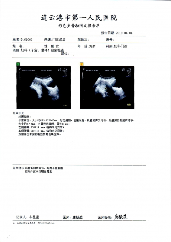 B超检查 0404