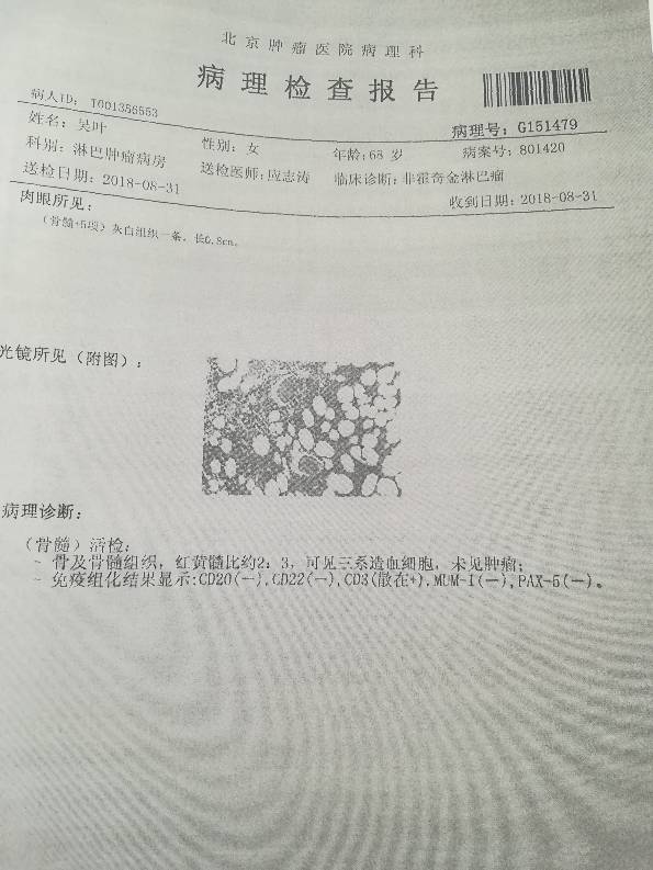 102632al3888xe218bcep8.jpg
