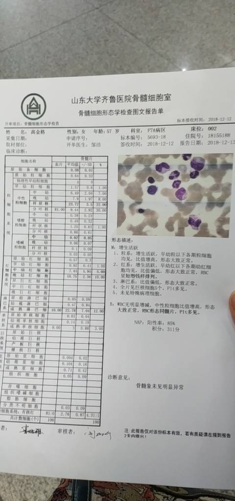 141155sz9yqehoe77pog09.jpg