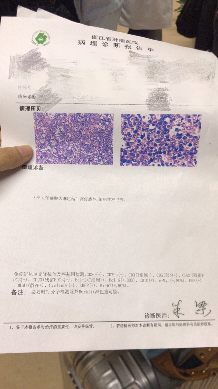 171121uu1vpcu4pbjv1vgu.jpg
