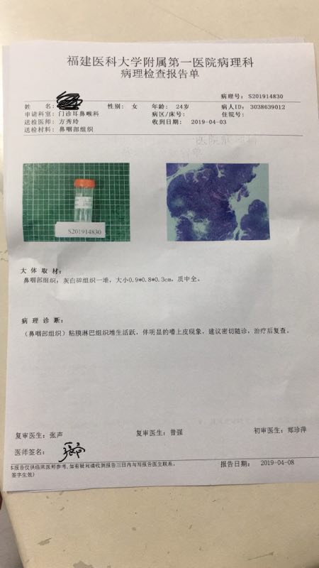 174419pbbzwh171yhi0bss.jpg