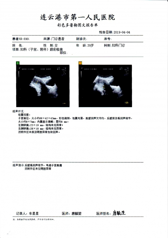 子宫彩超报告_20190404m.jpg