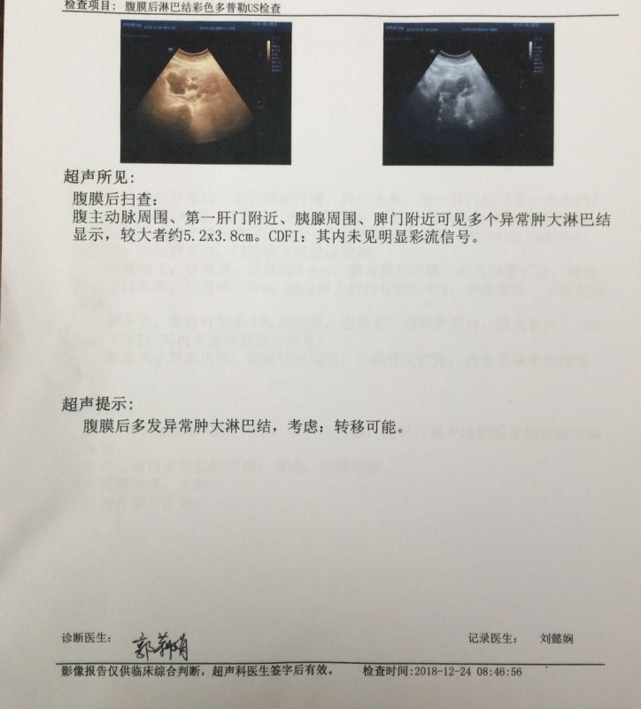 首次b超1.jpg